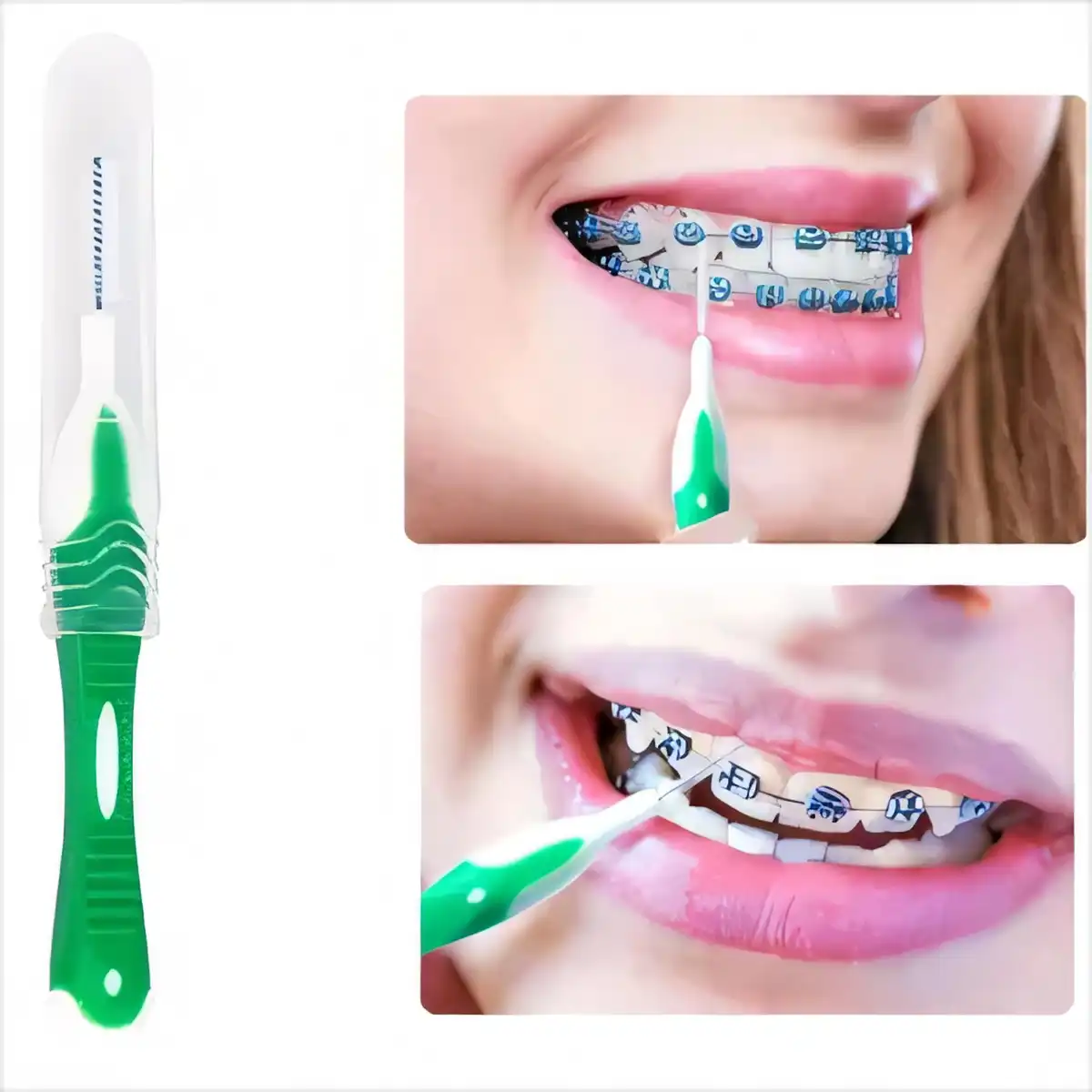 Complete Braces Care Kit 8 Piece product close-up